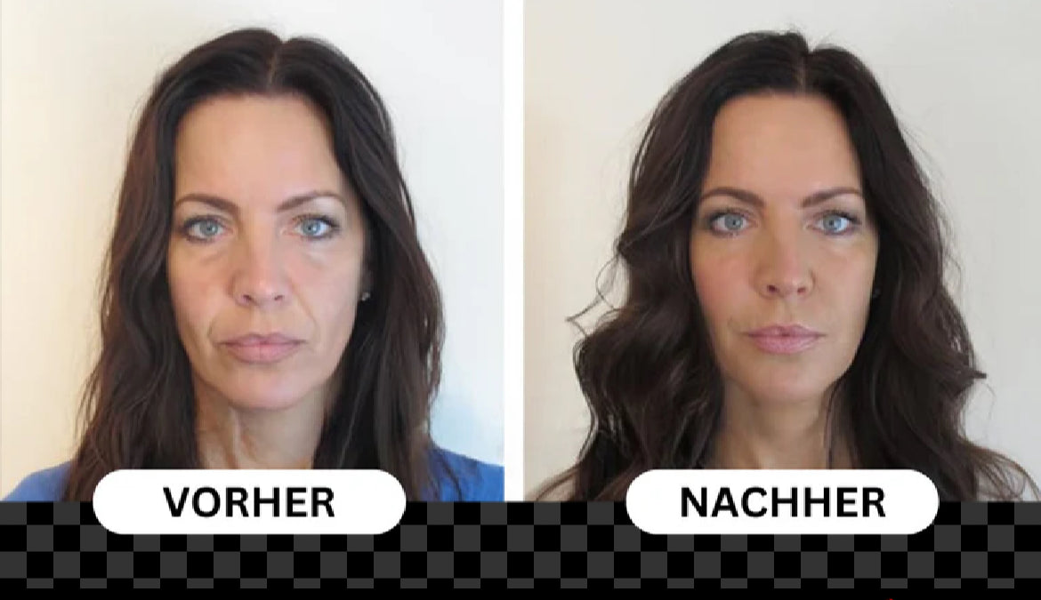 Vitalità ClearSkin Pro