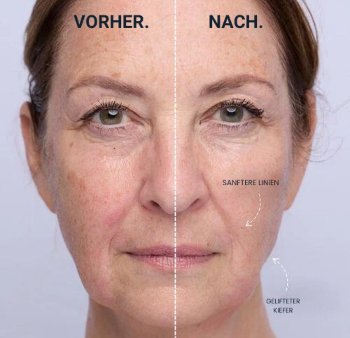 Vitalità ClearSkin Pro