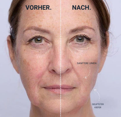 Vitalità ClearSkin Pro