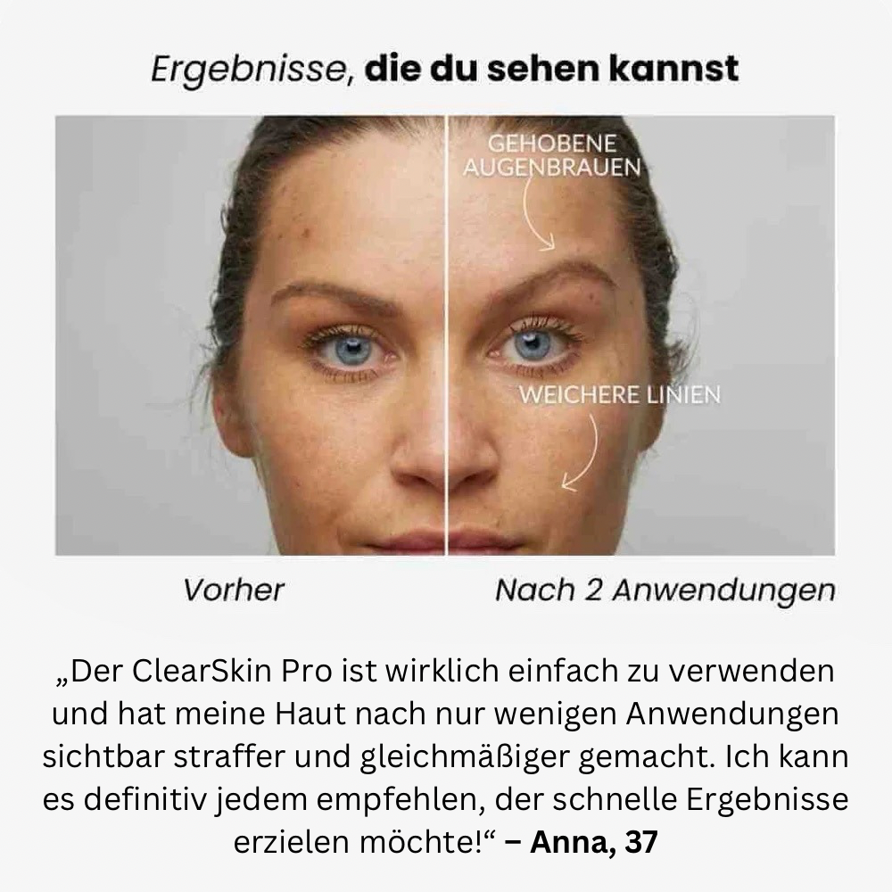 Vitalità ClearSkin Pro