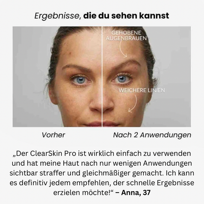 Vitalità ClearSkin Pro