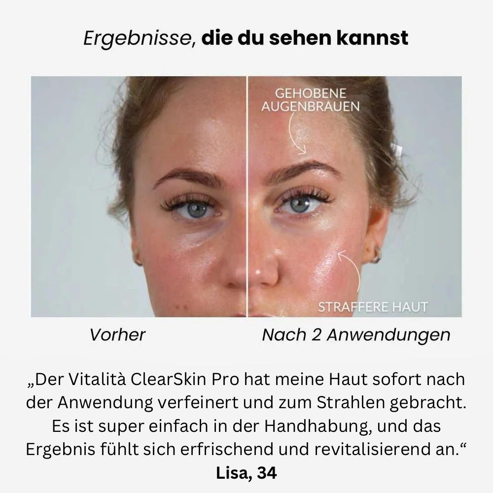 Vitalità ClearSkin Pro